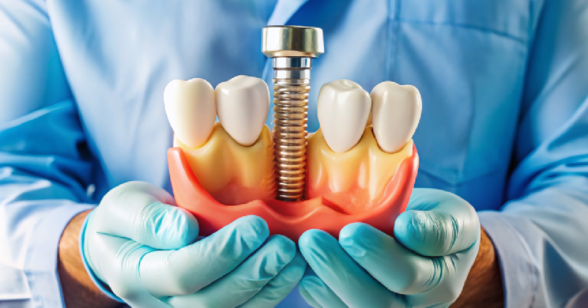Dental Implant procedure in Melbourne, FL
