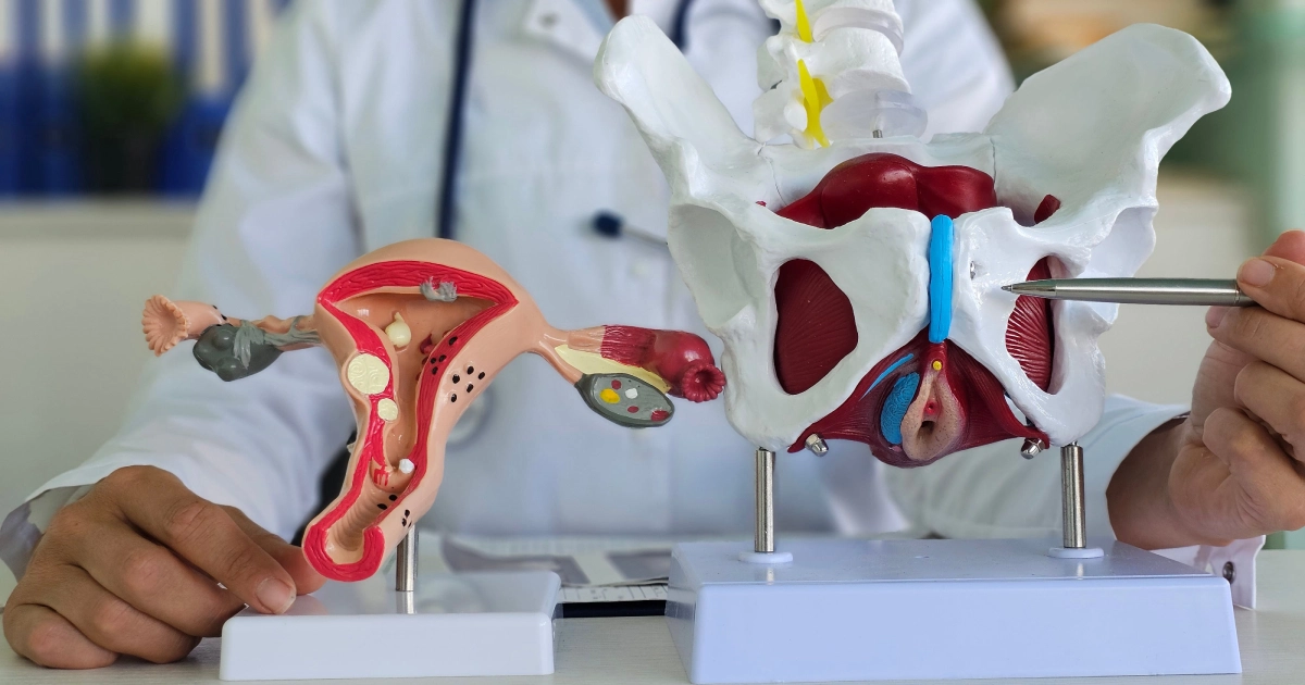 A doctor in Melbourne, FL points at a female pelvis model with a metal instrument, highlighting Emsella.