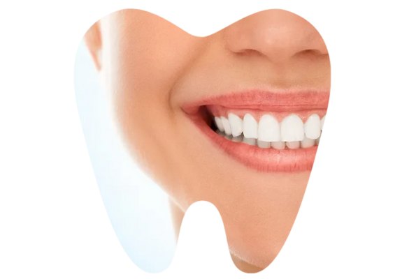 Teeth Whitening Teeth Whitening